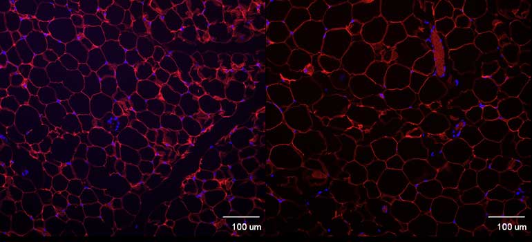 Johnson lab discovers possible “obesity gene”