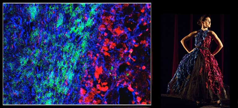 Target healthy cells to stop brain cancer “hijack”: Naus lab