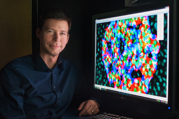 Timothy Kieffer awarded 2015 Till & McCulloch prize